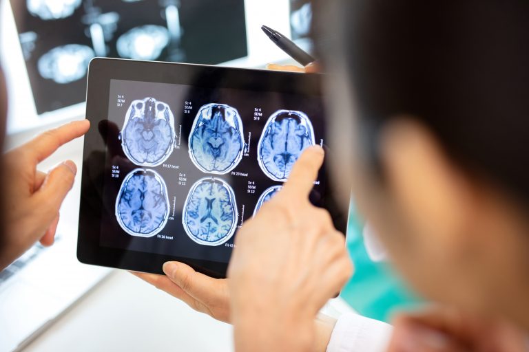 Physicians reviewing brain scan on a tablet in the office