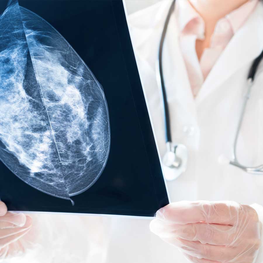 Breast Imaging Services Near Stamford, CT | Premier Imaging